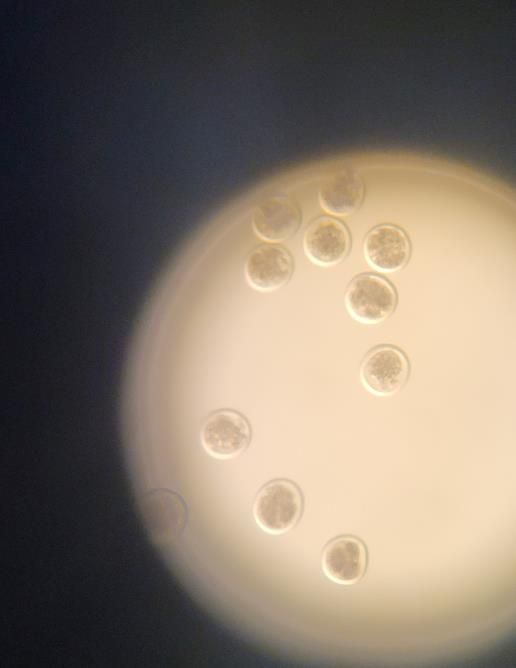 OPU수정란 기술 교육